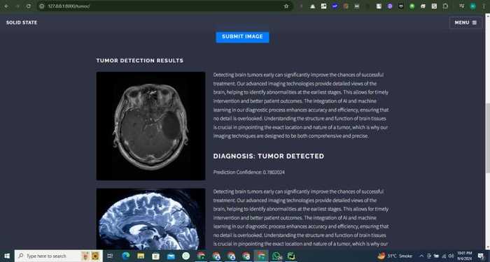 Brain Tumor Detector - Project by Hamza Bilal, Backend Developer and AI Engineer